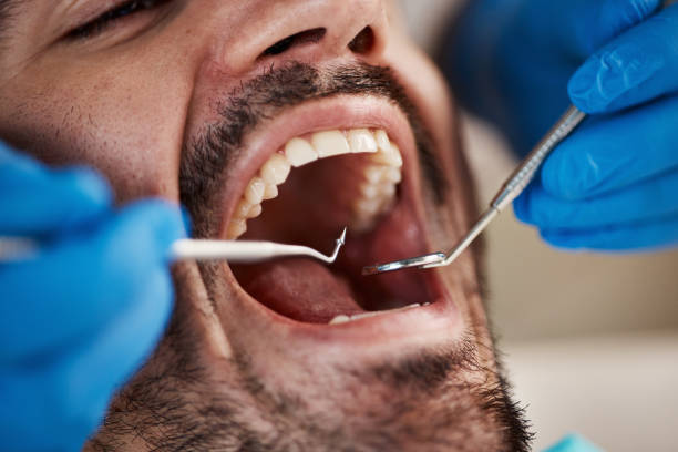 Best Emergency Denture Repair in Edgemont Park, MI
